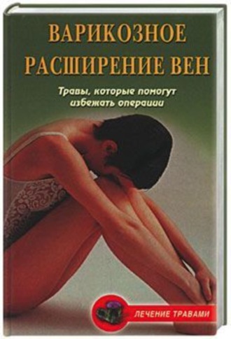 Ольга Абрамович, Вера Подколзина, Варикозное расширение вен. Травы, которые помогут избежать операции