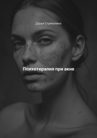 Психотерапия при акне Дарья Стрекалина, Психотерапия при акне